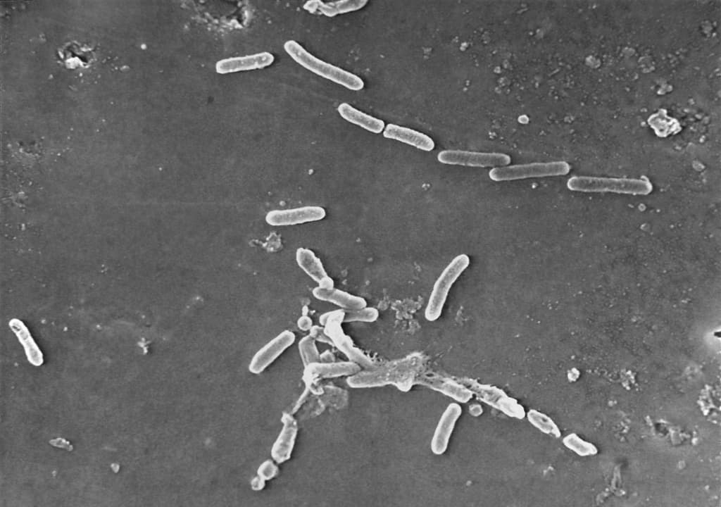 Imagen de microscopio electrónico proporcionada por los CDC que muestra la bacteria Pseudomonas aeruginosa en forma de bastón.