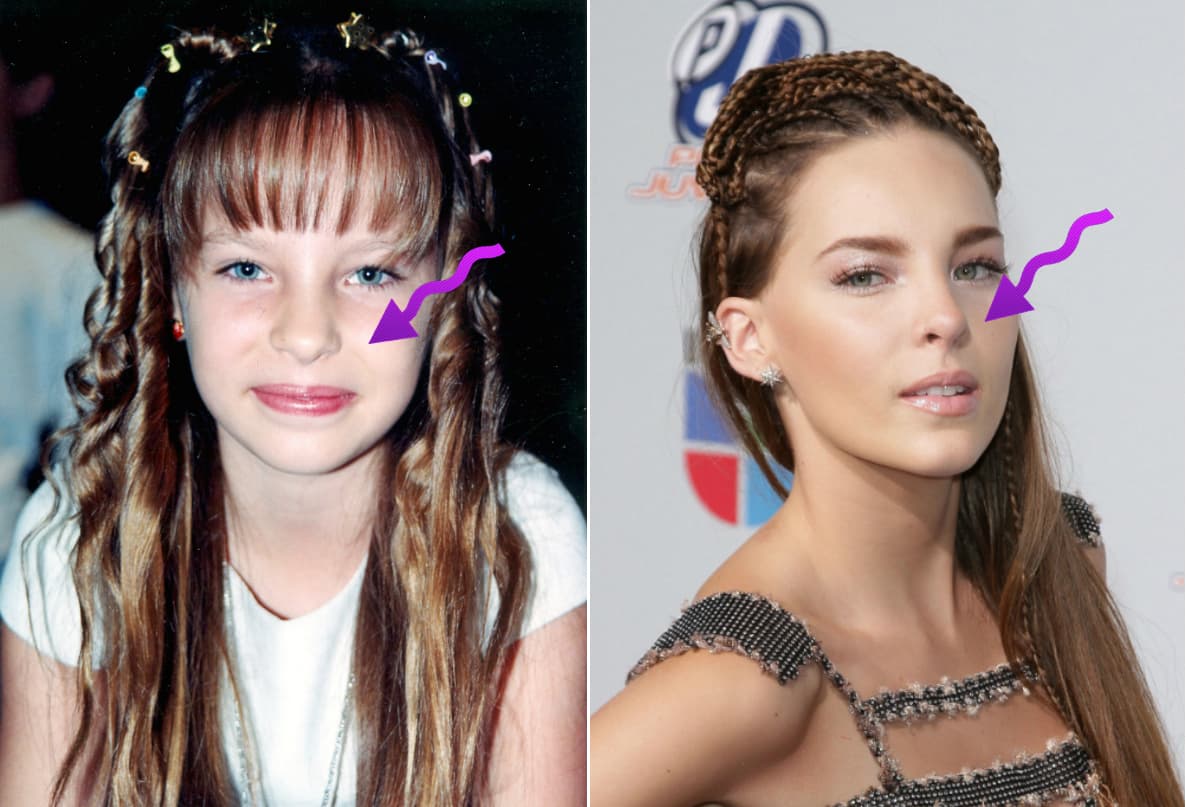 Belinda es muy jovencita pero ya es buena amiga del bisturí.