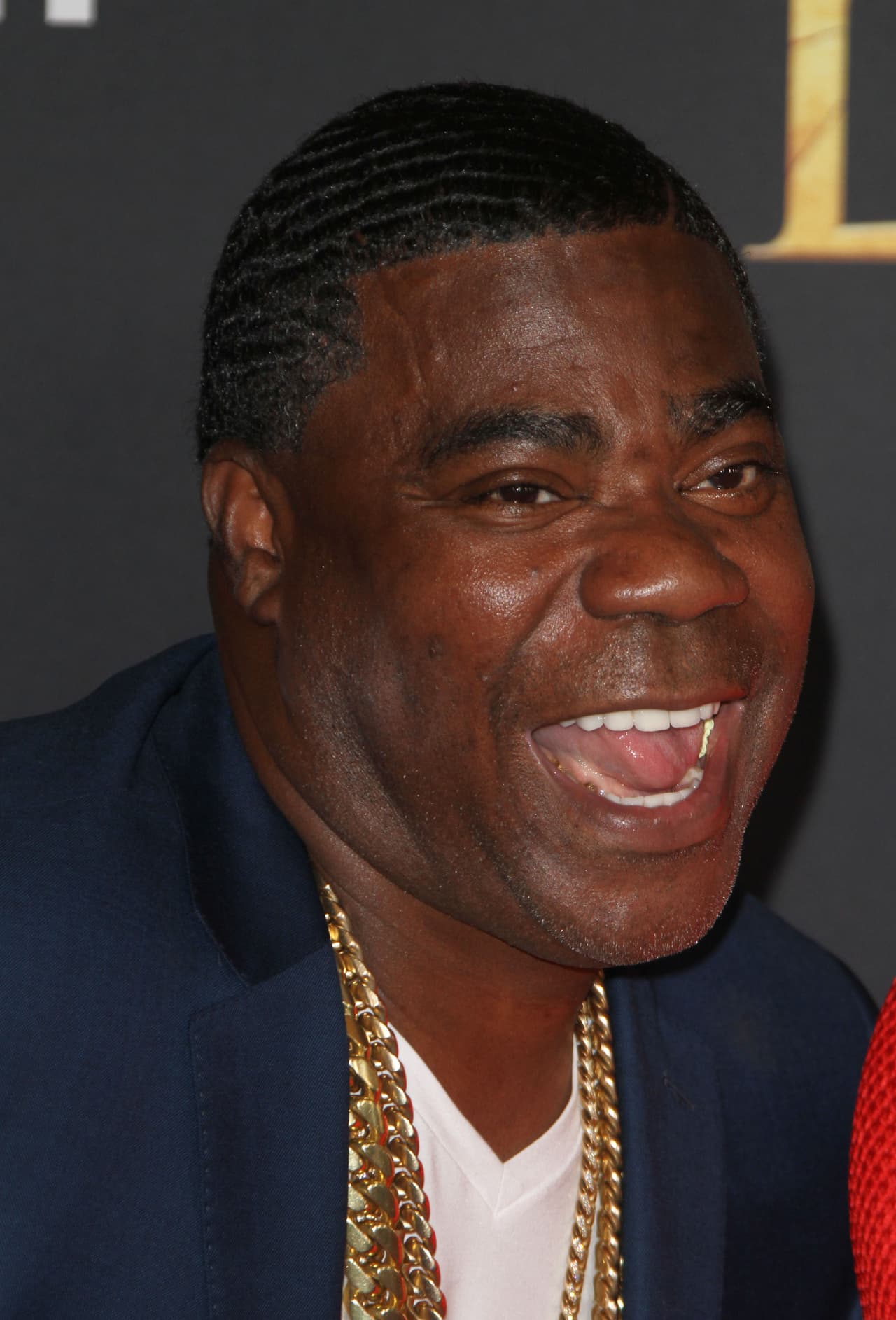El actor y comediante de 30 rock 
<b>Tracy Morgan</b> padece diabetes desde la década de los 90. Tenía 42 años cuando su enfermedad crónica se complicó y debió someterse a un trasplante de riñón, en diciembre de 2010.
