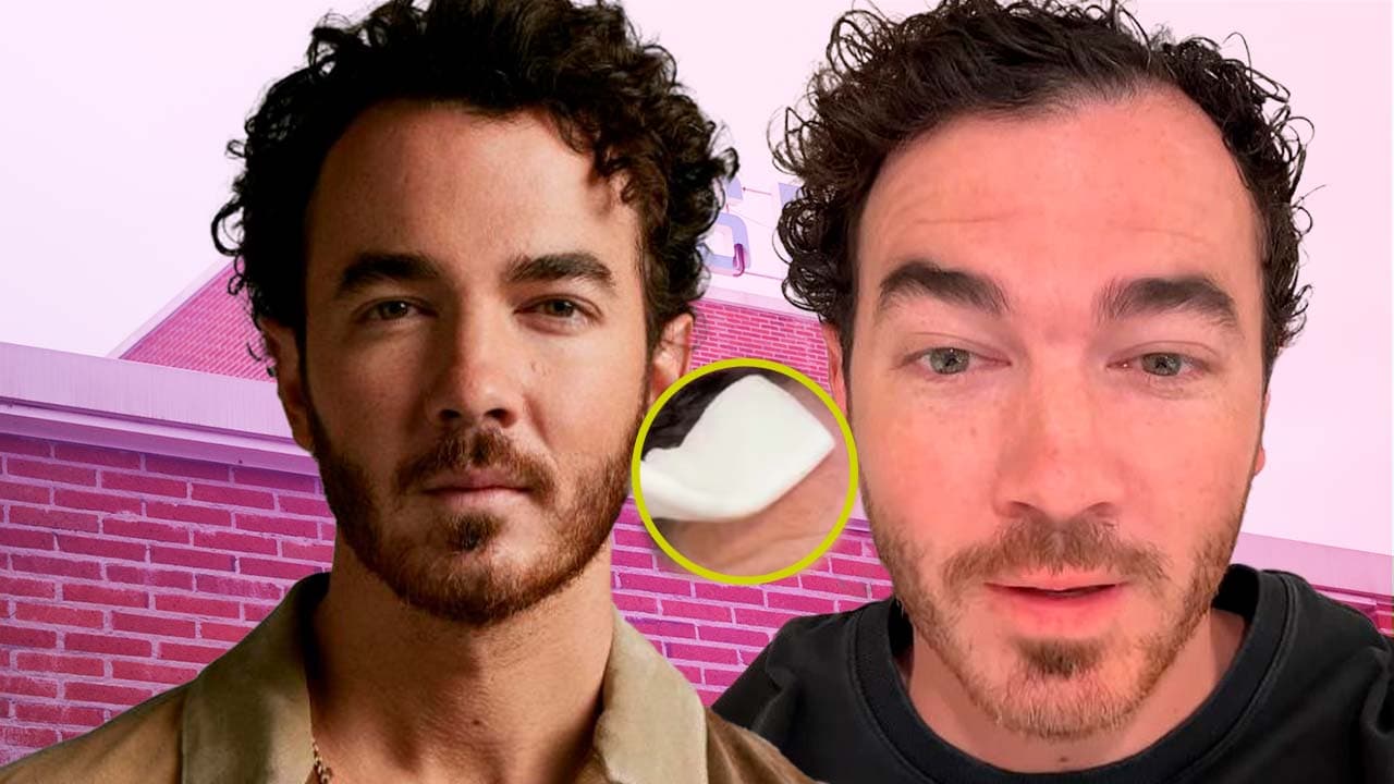 Así detectó Kevin Jonas cáncer en su piel: otros famosos que también lo tuvieron