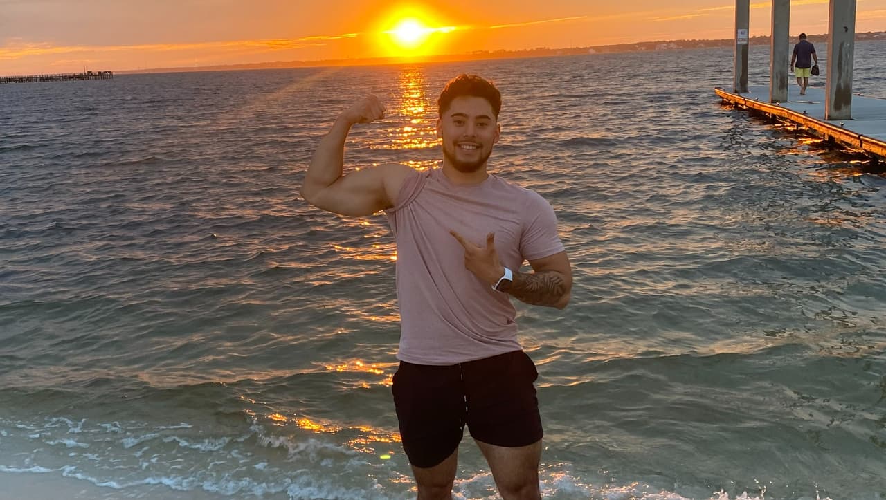 Un conductor descuidado “le arrancó” el brazo izquierdo tras volcar su auto: ahora busca ayuda para recuperar su vida