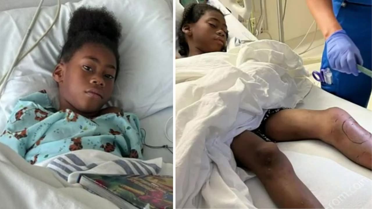 Niño de 7 años se recupera tras ser mordido por una serpiente venenosa