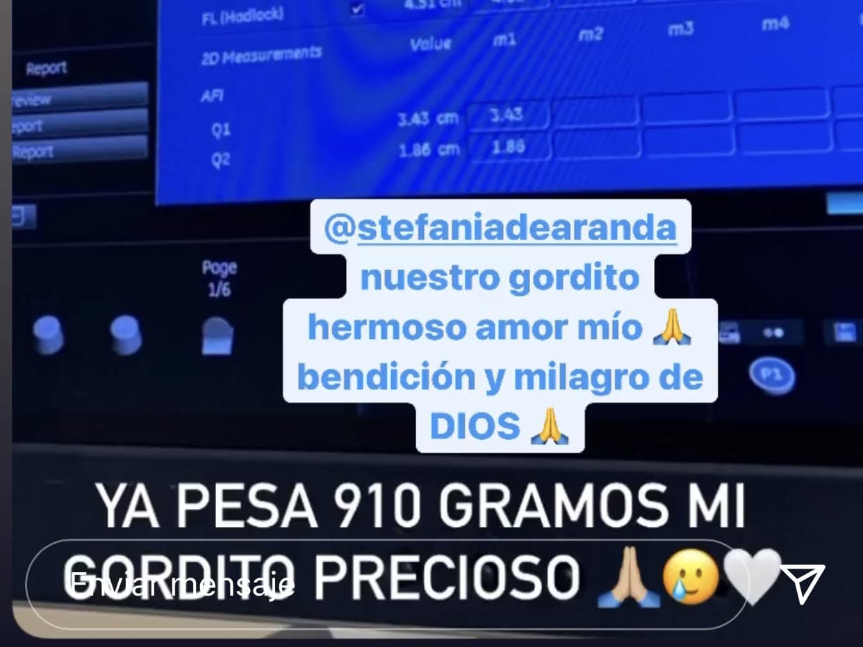 Emir Pabón publicó las mismas imágenes de su esposa, pero agregó mensajes de agradecimiento y amor para su "gordito": "Bendición y milagro de Dios", escribió. 
<br>