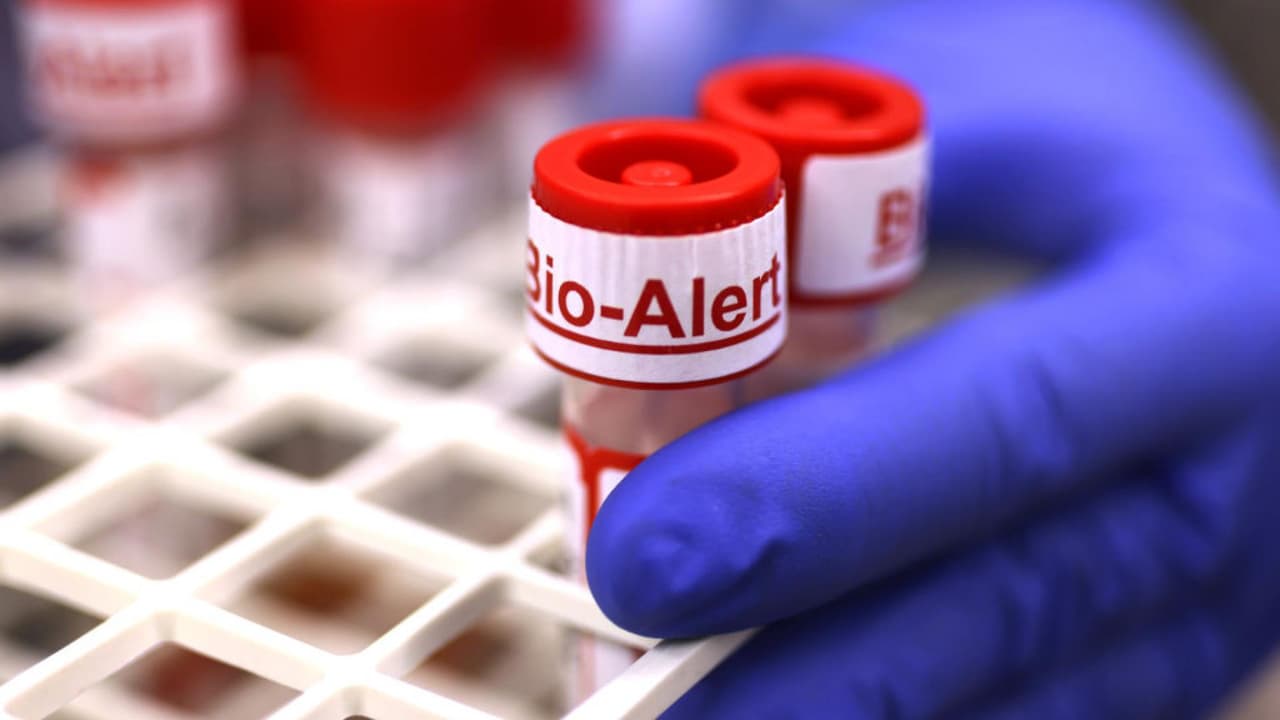 “No vamos a cometer ese mismo error”: experto asegura que cualquiera puede contagiarse con la viruela del mono