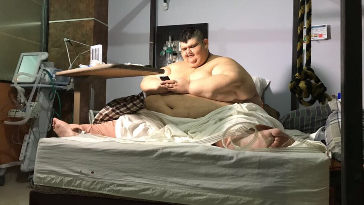 El hombre más obeso del mundo está en camino a alcanzar su peso ideal