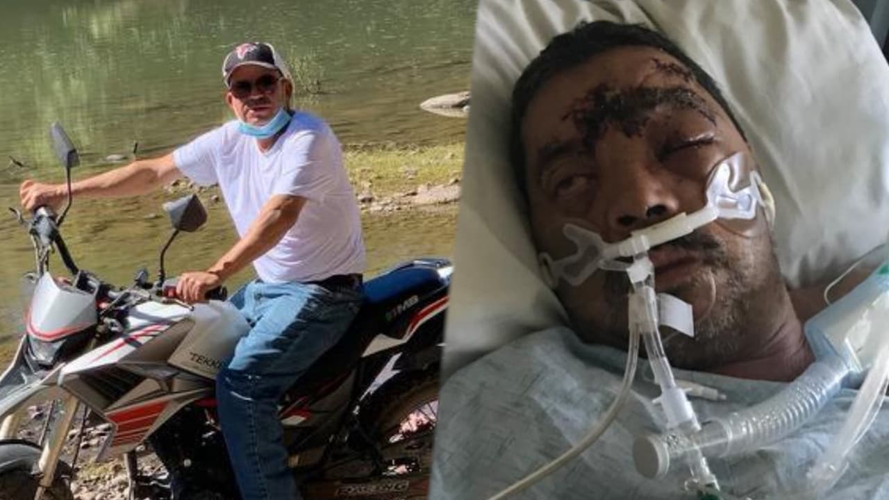 Inmigrante lucha por su vida tras ser golpeado durante robo en Landcaster