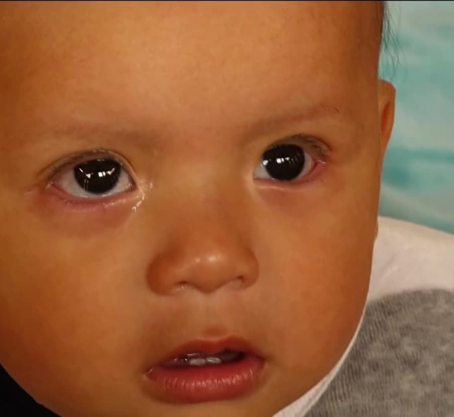 A los tres meses de haber nacido su hijo, Patricio Paltín notó algo extraño en uno de sus ojos, por lo que acudió al doctor para que le realizaran los exámenes médicos correspondientes. 
<br>