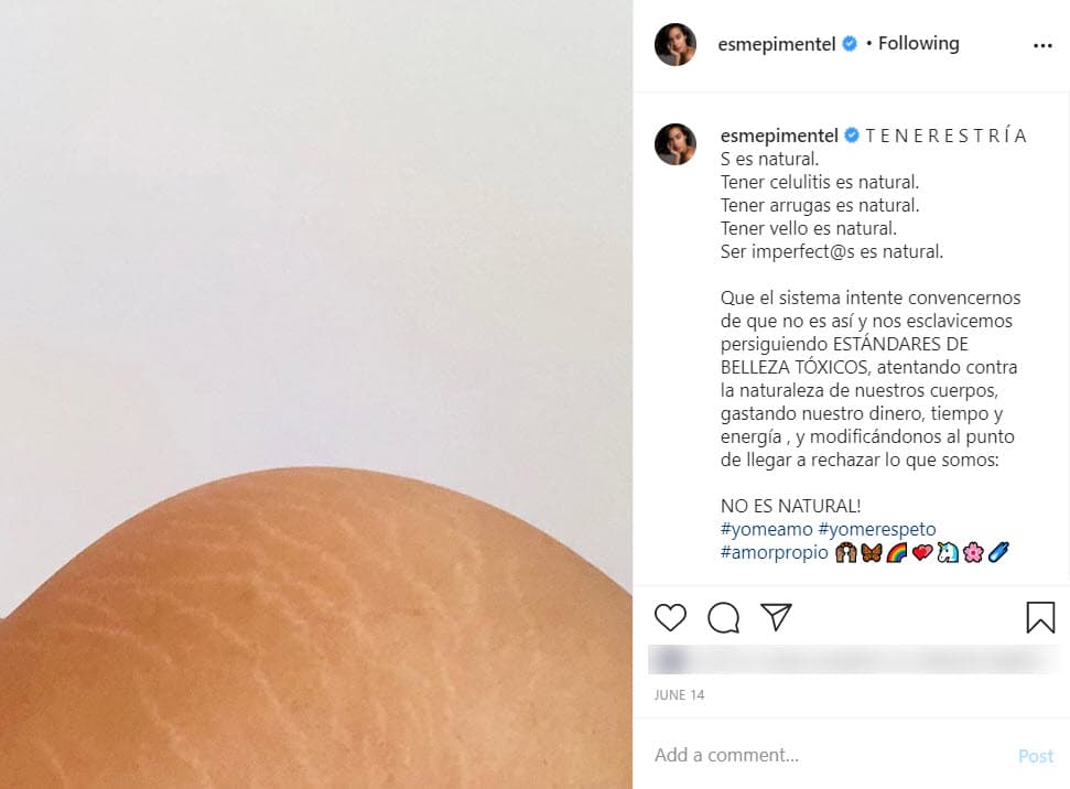 Días antes de que compartiera imágenes de la revista en su perfil de Instagram, hizo un "experimento" al publicar esta foto de su glúteo donde se aprecian las marcas y contó que obtuvo una 
<b>respuesta inesperada</b> de los usuarios.
<br>