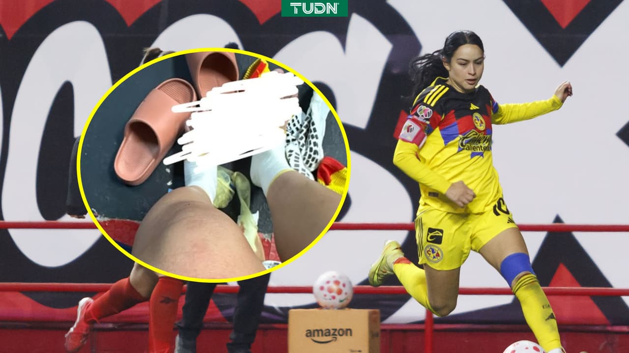 ¡Como Gio dos Santos! Scarlett Camberos exhibe en redes gravedad de su lesión