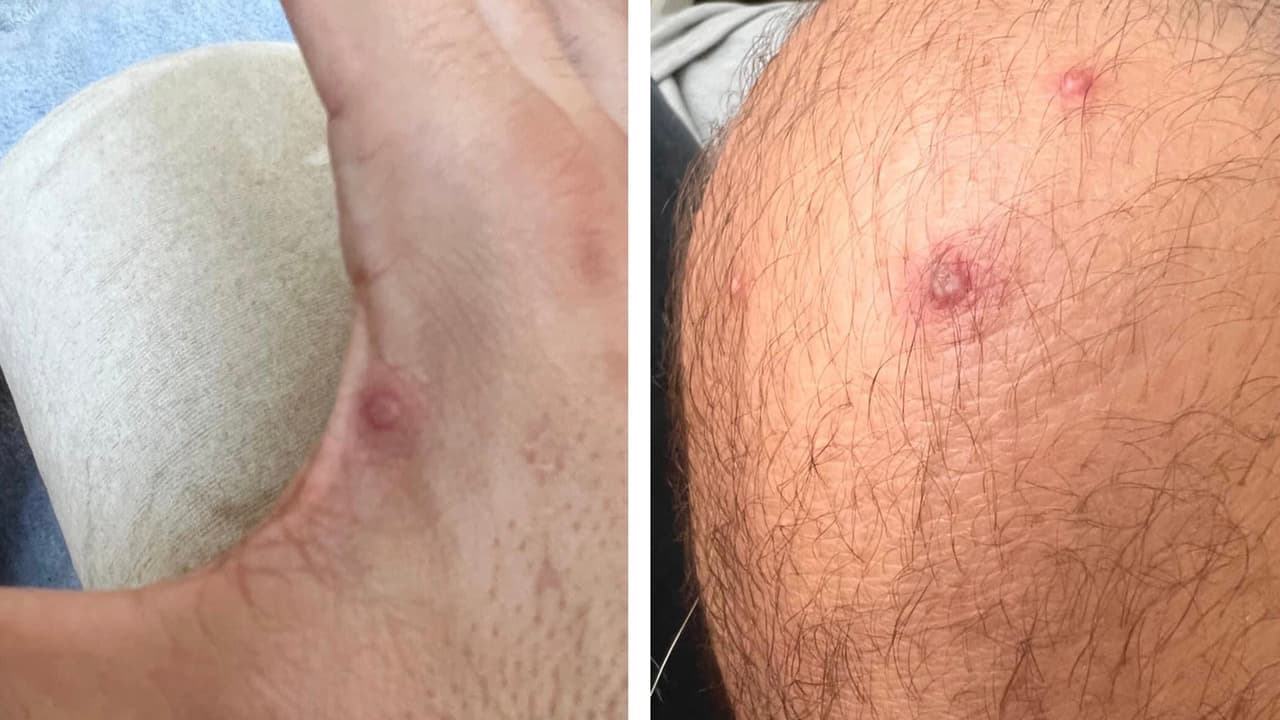 Con los casos reportados en Houston y el condado Harris, existe la preocupación entre padres de familia ahora que los niños regresan en la escuela tras las vacaciones de verano.