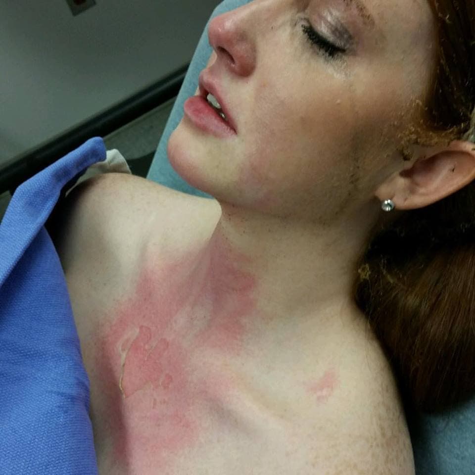 "No cocinen con su hijo en brazos" y otros consejos que aprendimos del susto de esta madre en Facebook