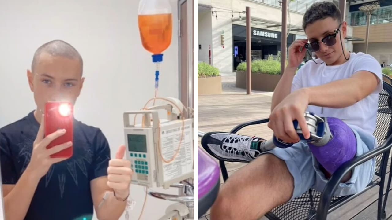 Fallece Juanpi, tiktoker que compartió su lucha contra el cáncer con humor: así lo despidieron