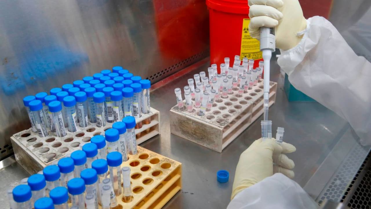 La "revolucionaria" prueba de saliva que podría marcar un hito en el control de la pandemia