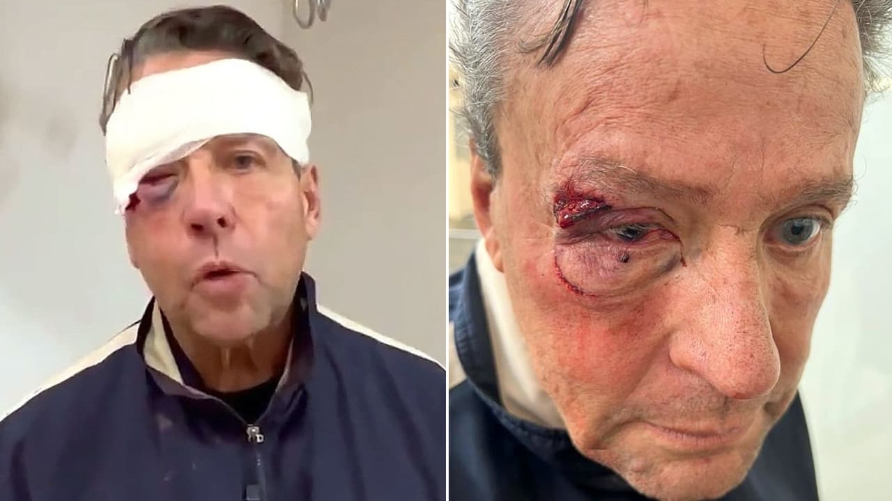 Alfredo Adame dice que su ojo derecho quedó “arriba” del otro y perdió visibilidad tras trifulca