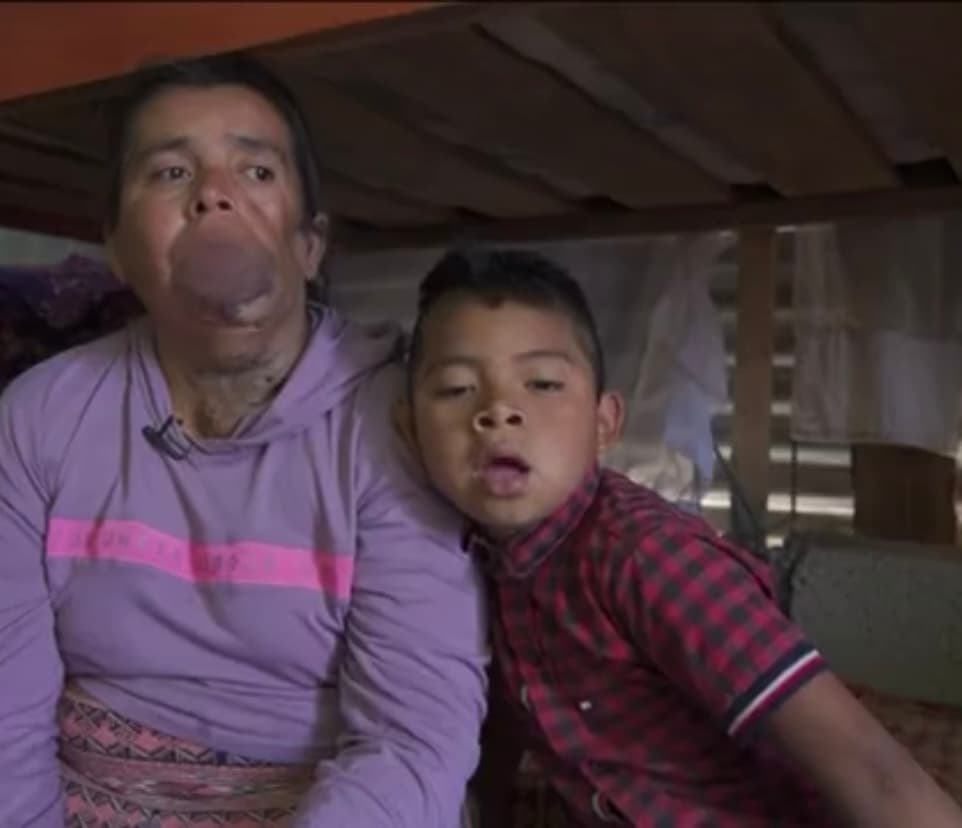 Pero ni ese durísimo momento la terminó de abatir y, aunque reconoce que su apariencia puede ser chocante, ella ve en el espejo a una mujer “bien guerrera y luchona” que siempre ve 
<b>“una pequeña luz cuando el panorama luce negro”. </b>
<br>