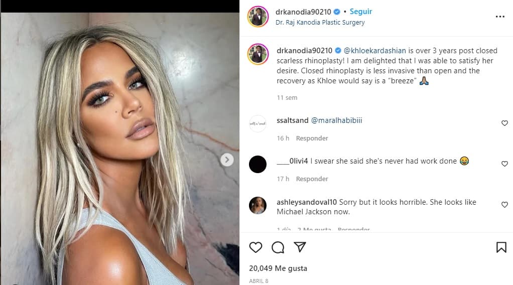"3 años después de una rinoplastia cerrada sin cicatriz", dijo el doctor en el post en donde se ve a Khloé en una gramorosa foto. "Estoy encantado de haber satisfecho su deseo", comentó Raj Kanodia.