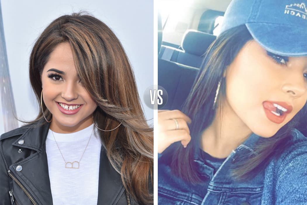 ¡Becky G transformó su sonrisa! Mira las fotos aquí