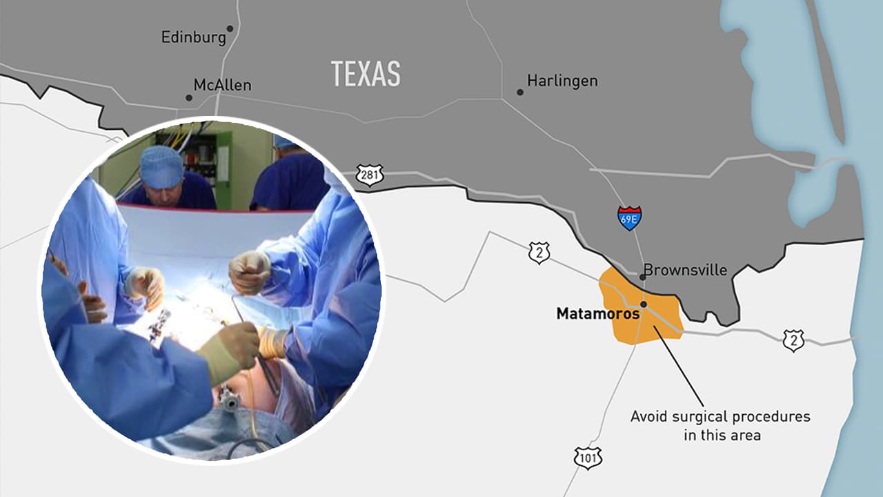 Alerta: Una persona de Texas murió y cuatro están hospitalizadas tras cirugías en Matamoros