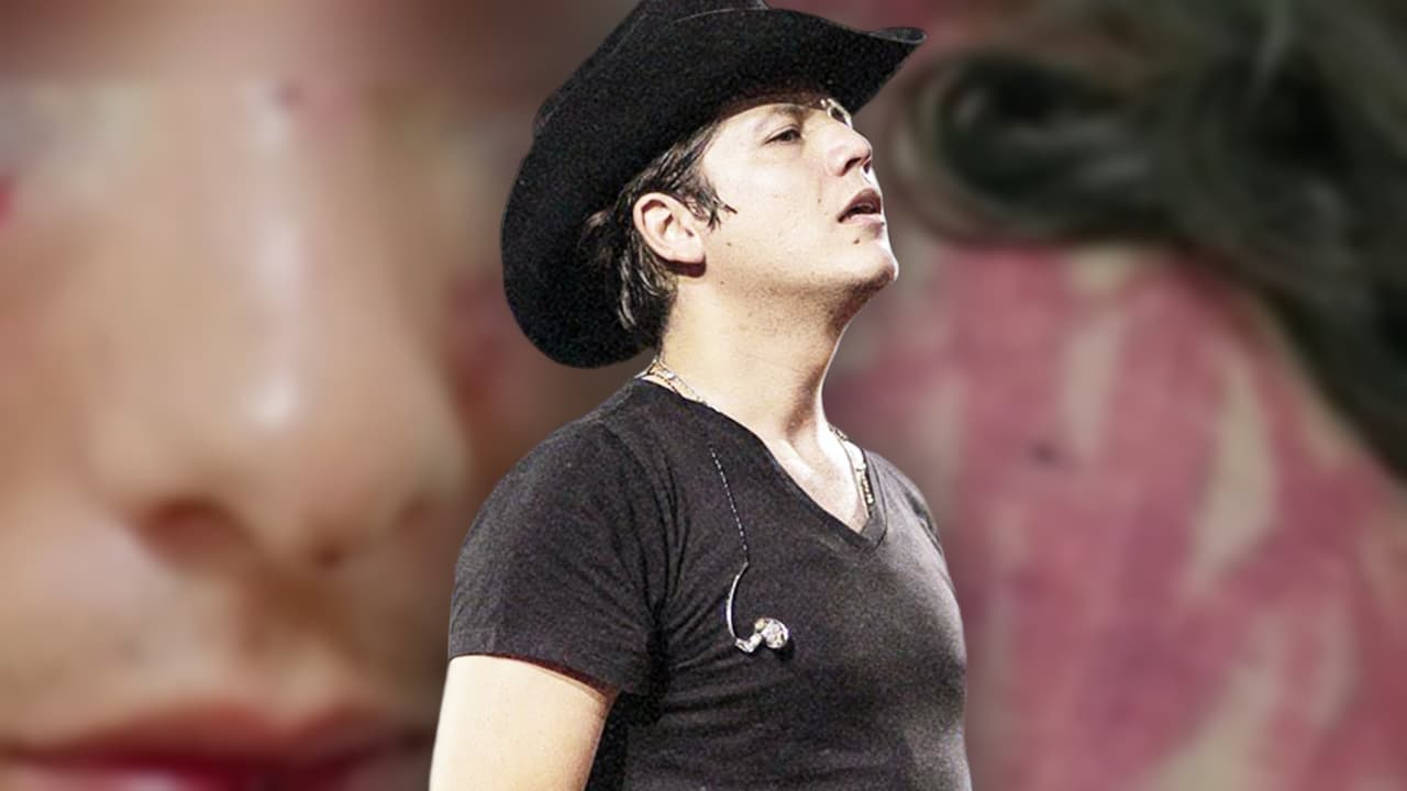 Problemas de riñones y pómulos fracturados, las secuelas que enfrentan las presuntas víctimas de Remmy Valenzuela