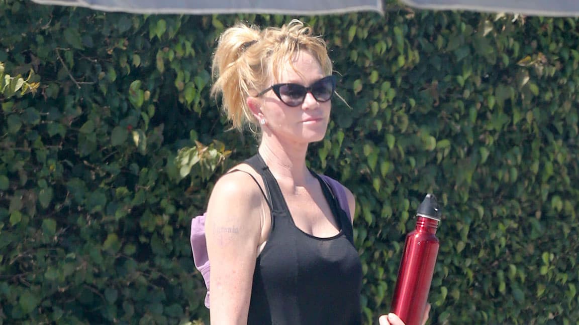 Así luce ahora el brazo de Melanie.