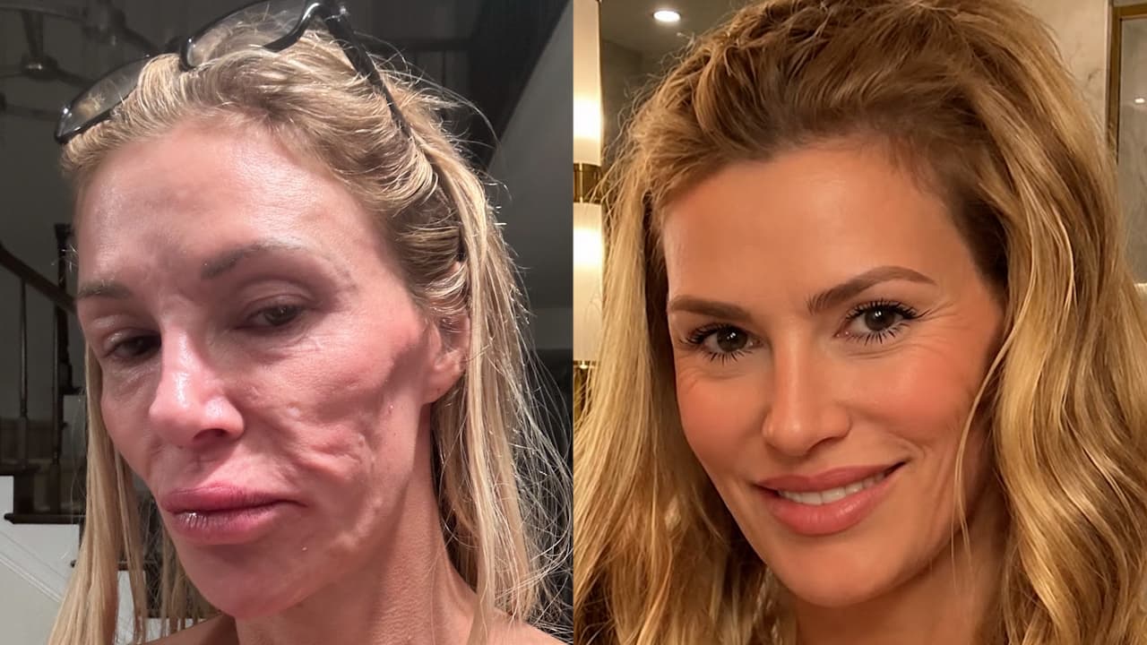 Estrella de ‘Real housewives of Beverly Hills’ tiene tumor en rostro tras infección de "parásito" 