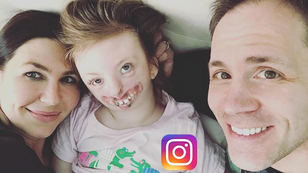 Un año sin #SweetSophia, la niña con malformaciones faciales que se convirtió en símbolo contra la discriminación