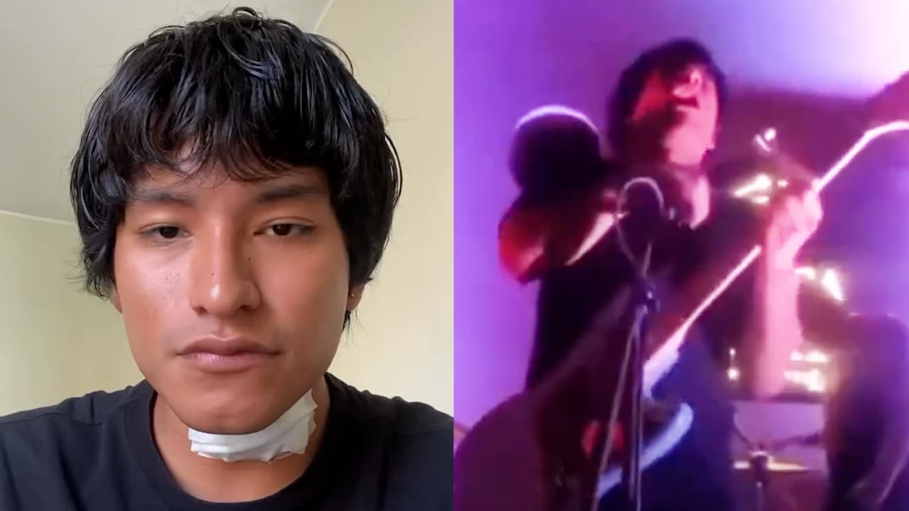 Dramático video: momento en que famoso cantante peruano es electrocutado en pleno concierto 