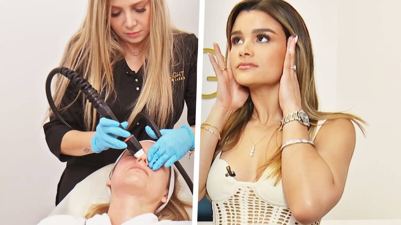 Clarissa Molina enseñó la técnica para eliminar las líneas de expresión: ¿de qué se trata?