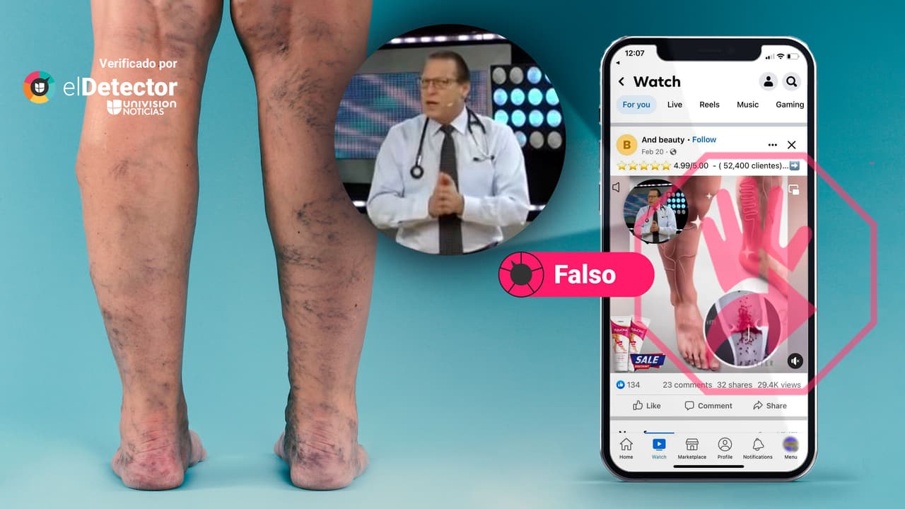 Este doctor NO promueve un medicamento para las várices, como muestra video viral