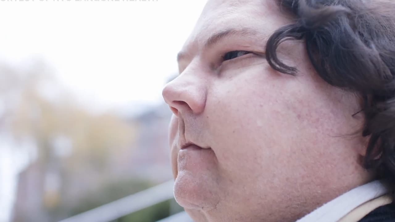 Joe DiMeo, de 22 años, recibió quemaduras de tercer grado en más del 80% de su cuerpo por un accidente automovilístico en julio de 2018. Pese a las dificultades por la pandemia, un equipo de 140 profesionales médicos realizaron el histórico procedimiento en Nueva York.