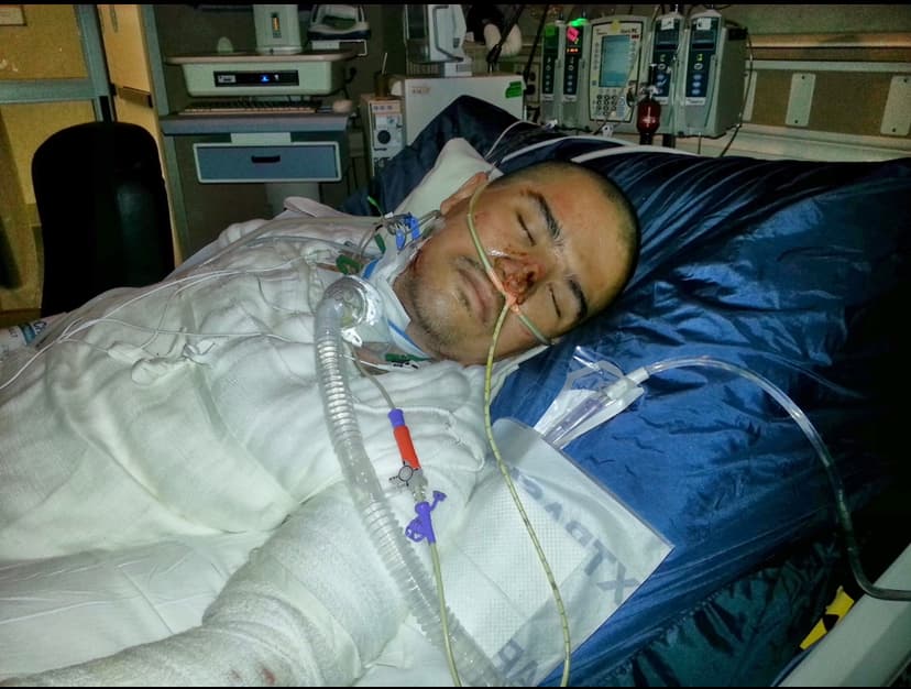 Tras salir de prisión se dedicó a trabajar en la pizca de la uva, y luego en una fábrica de aceites donde hacía doble turno, y también estudiaba. Durante ese tiempo tuvo 
<b>un accidente que lo tuvo al borde de la muerte.</b>