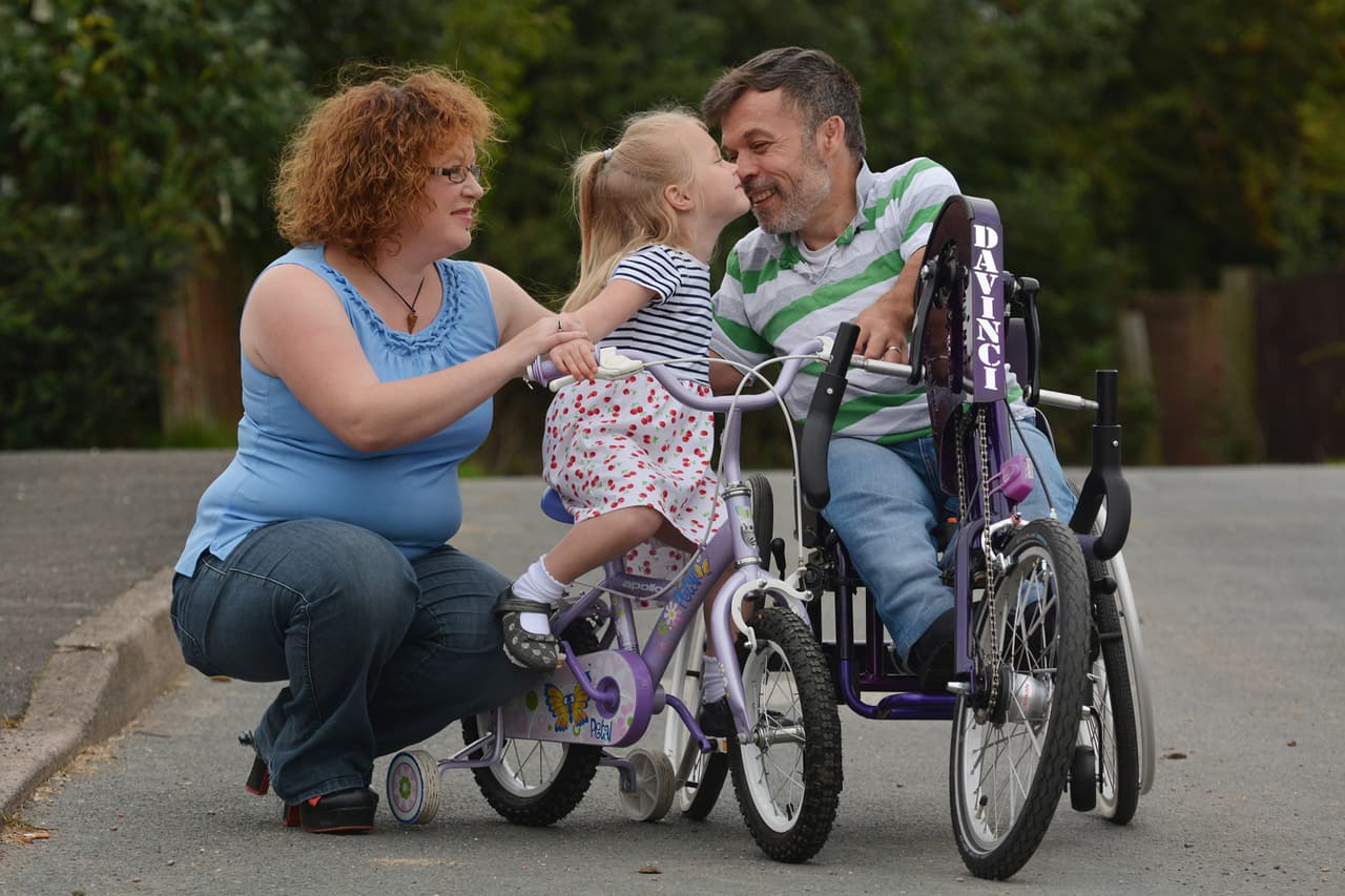 Esta condición es de origen genético y poco frecuente. Se caracteriza por la baja estatura, las extremidades cortas y diversas formaciones en articulaciones.