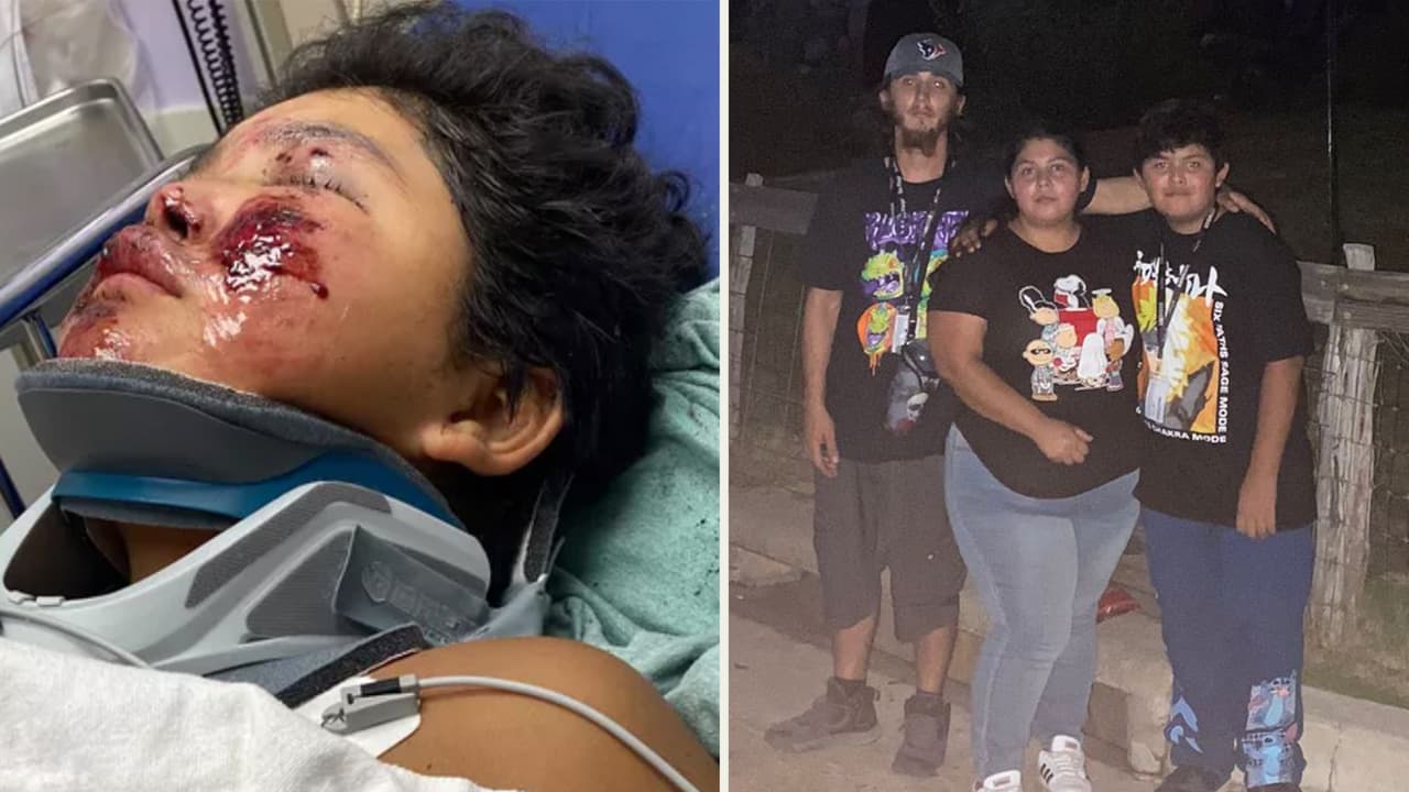 Familia ofrece recompensa para localizar a sospechoso que atropelló a niño de 11 años y no se detuvo