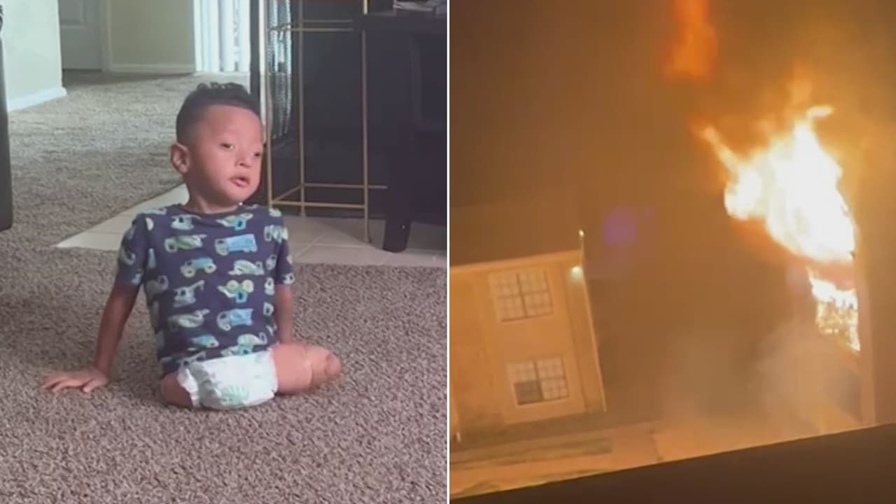 Ayuda de Impacto: Un matrimonio perdió todo en un incendio años después de que a su bebé le amputaran las piernas