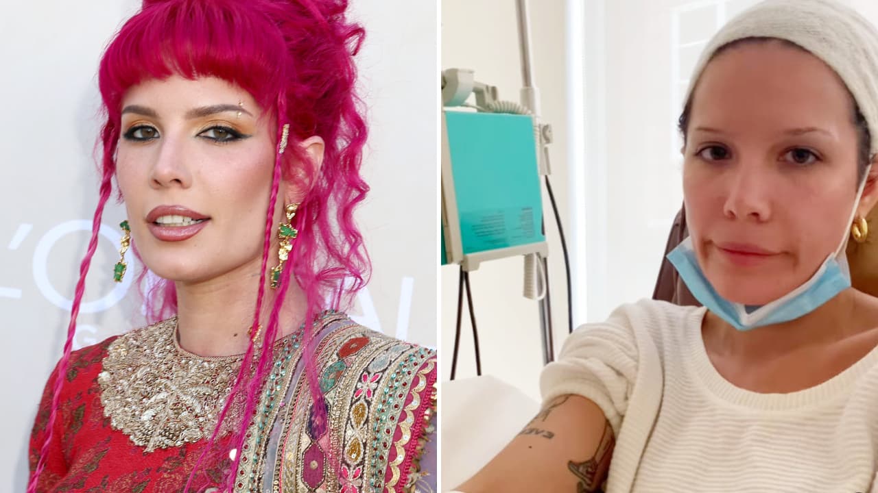 Estrella de la música pop padece lupus y "un raro trastorno": "Tengo suerte de estar viva"