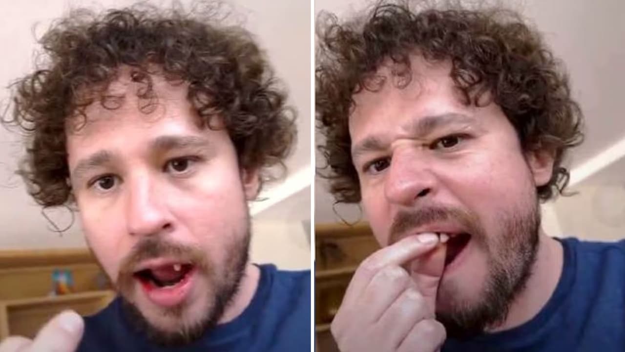 Luisito Comunica causa polémica: se le caen los dientes en plena transmisión en vivo.