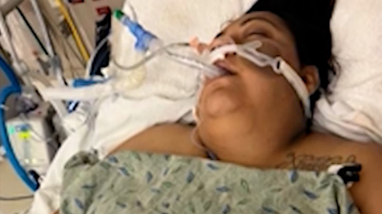 Intentó defender a su madre de su agresor y la hirió de forma accidental; ella está hospitalizada