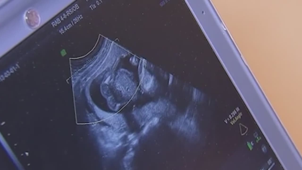 Aborto en Arizona: cuál es la situación en el estado a 4 años de revertir Roe vs. Wade