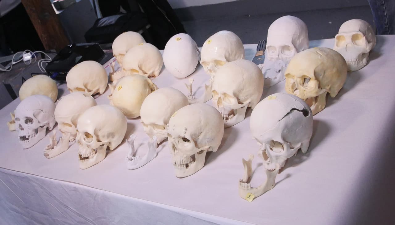 Cráneos entregados por la oficina forense.
