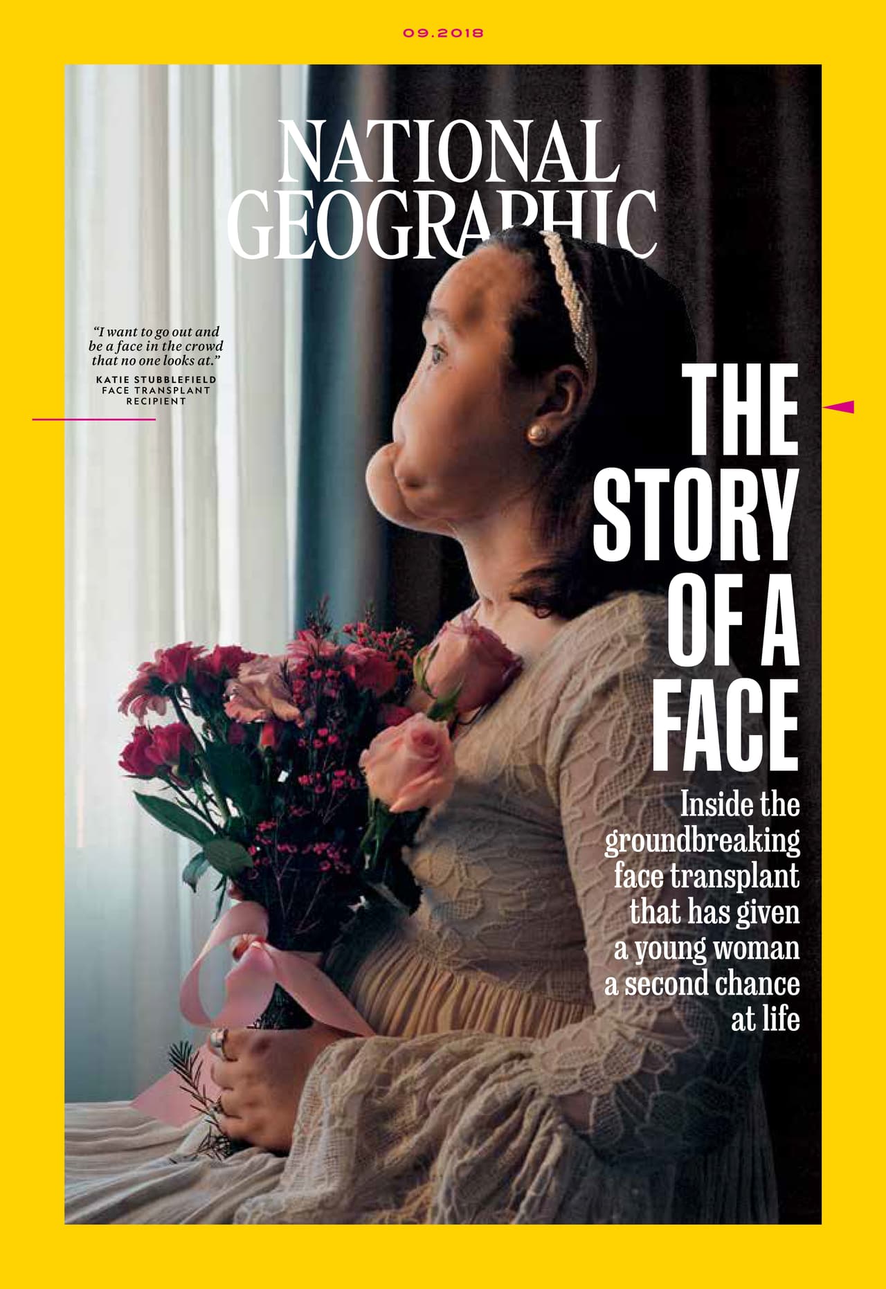 Portada de la revista National Geographic en su edición de septiembre, protagonizada por Katie Stubblefield, la jovencita que a sus 18 años intentó suicidarse. Su rostro quedó desfigurado después de que ella misma se disparara. Pero sobrevivió y emprendió un camino para conseguir un nuevo rostro.