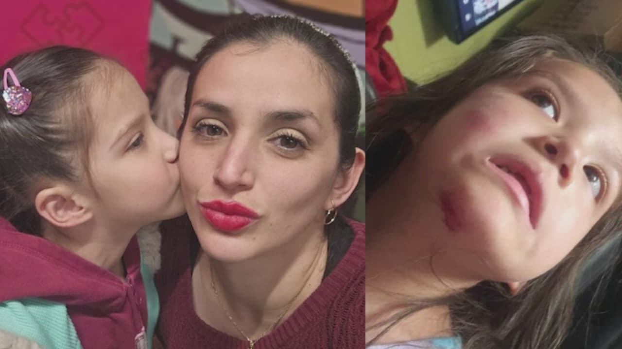 Madre denuncia que la escuela de su hija de 6 años la rechaza por padecer epilepsia