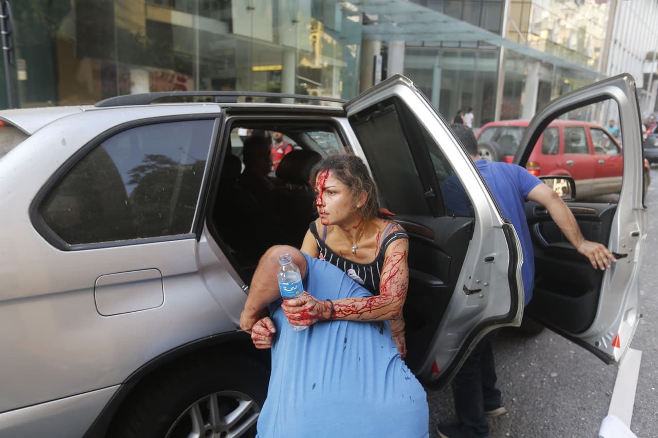 Una mujer herida ayuda a otros en la zona afectada por la explosión.
<br>