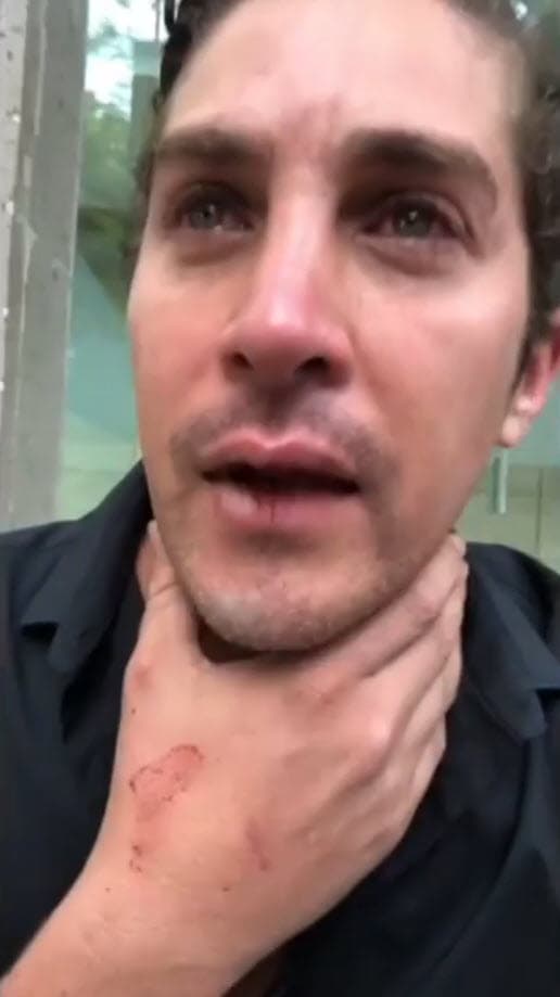 Con la voz quebrada, dijo que estaba pasando por una situación difícil: "Señores, esto es una cosa muy complicada, a veces piensan que los hombres le pegan a las mujeres, esta mujer me reventó el hocico de un putazo".