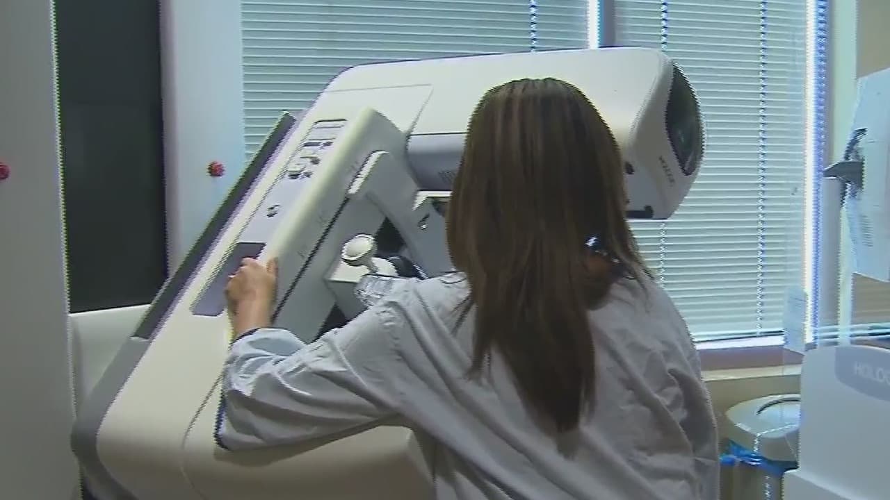 Estos son los factores de riesgo y señales para detectar el cáncer de mama