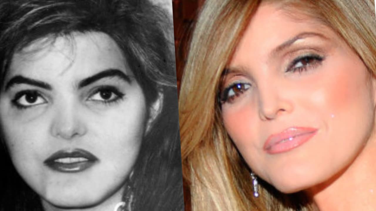 <h3 class="cms-H3-H3">Ana Bárbara</h3>
<br>
<br>La cantante es una de las celebridades que mejor se mantienen en el tiempo, y en varias ocasionas ha negado que su apariencia física sea producto de cirugías estéticas. La artista mexicana confesó a sus seguidores que por motivos de salud había tenido que hacerse arreglos en la nariz, y aseguró que luego de esta cirugía respiraba mejor que nunca.