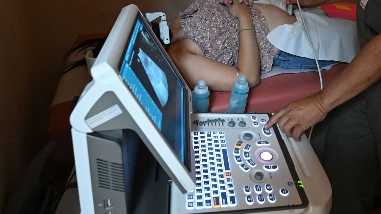 Senado de Florida aprueba el proyecto que busca prohibir el aborto después de las seis semanas de gestación