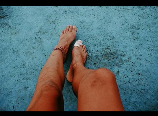 Aunque le dolió, se mostró orgullosa de sus cicactrices.