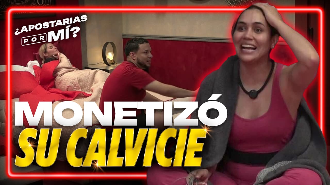 Tiby se estaba quedando calva por el estrés pero supo facturar su problema