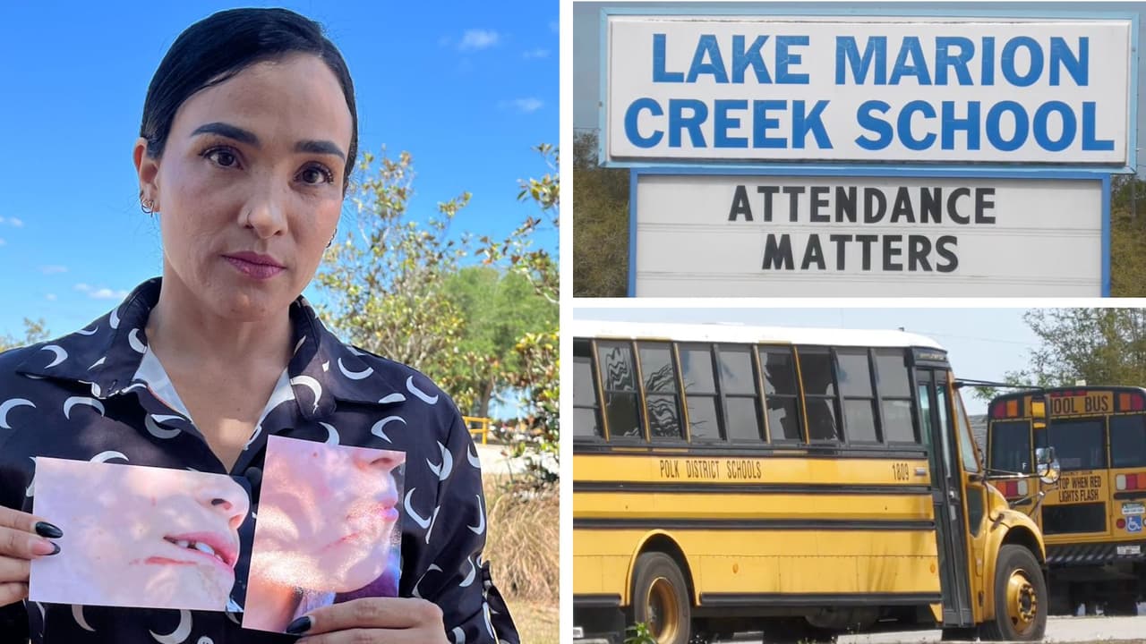"Esto es una injusticia": Madre denuncia agresión contra su hijo con necesidades especiales por personal del autobús escolar