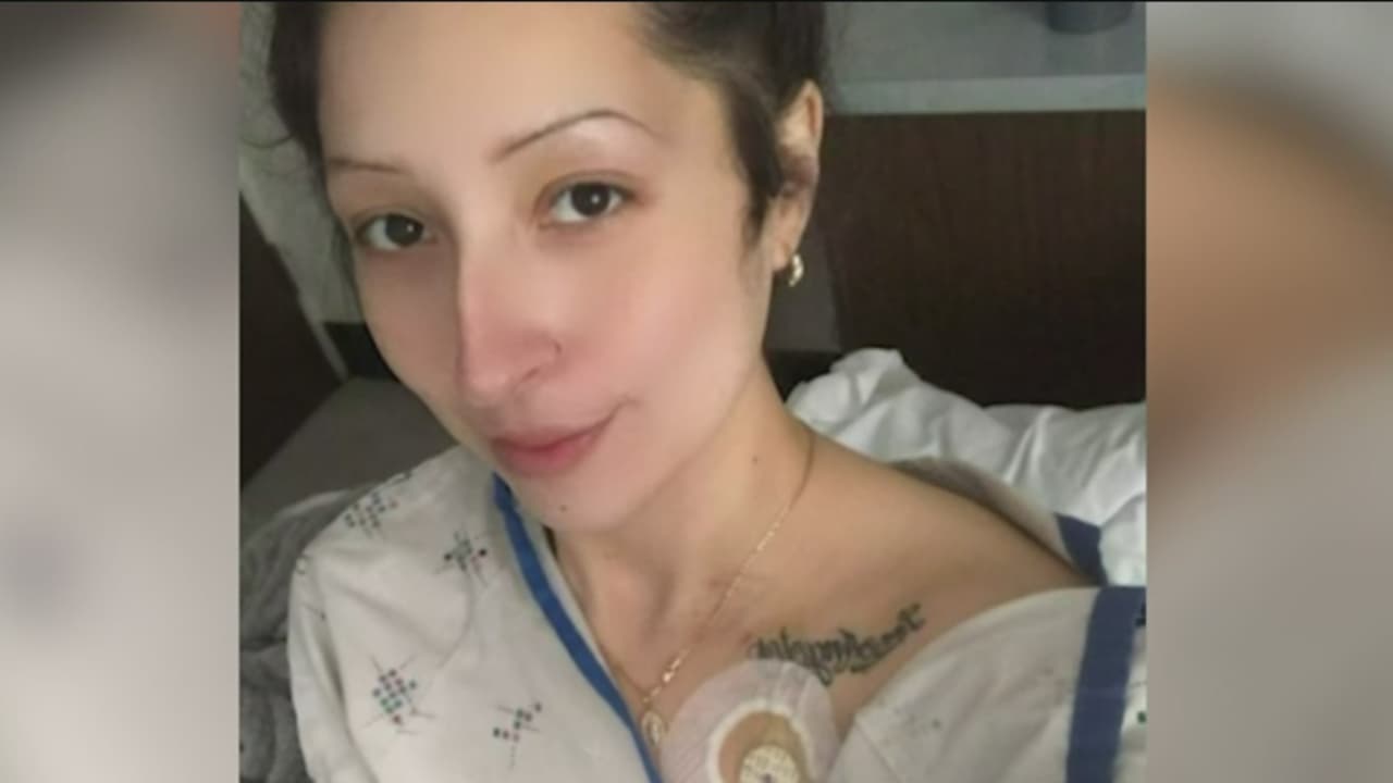 Cáncer colorrectal, un riesgo para todos: habla sobreviviente que lo enfrentó a los 29 años